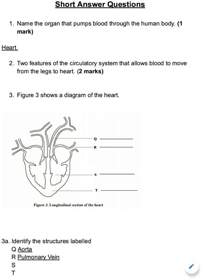 Labelling the heart 2 features of the circulatory system that allows blood to move-example-1