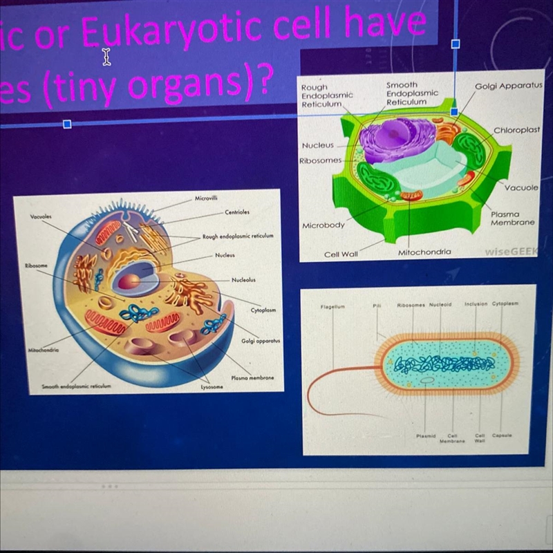 Does a Prokaryotic or Eukaryotic cell have organelles (tiny organs)? Prokaryotic: Eukaryotic-example-1