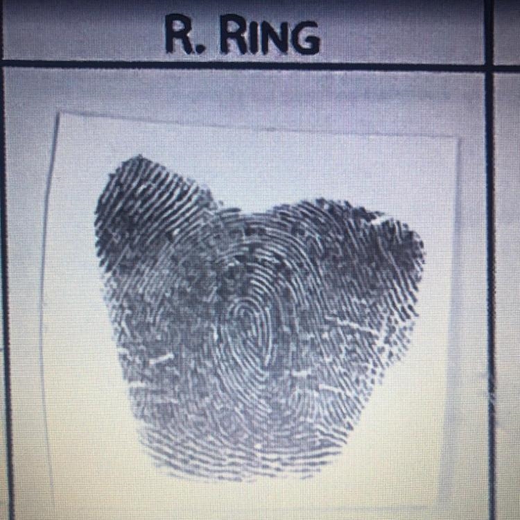 What kind of fingerprint pattern do they have loops or whorls?-example-1