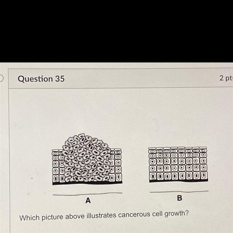 I need help please Is it b , a , both or neither-example-1