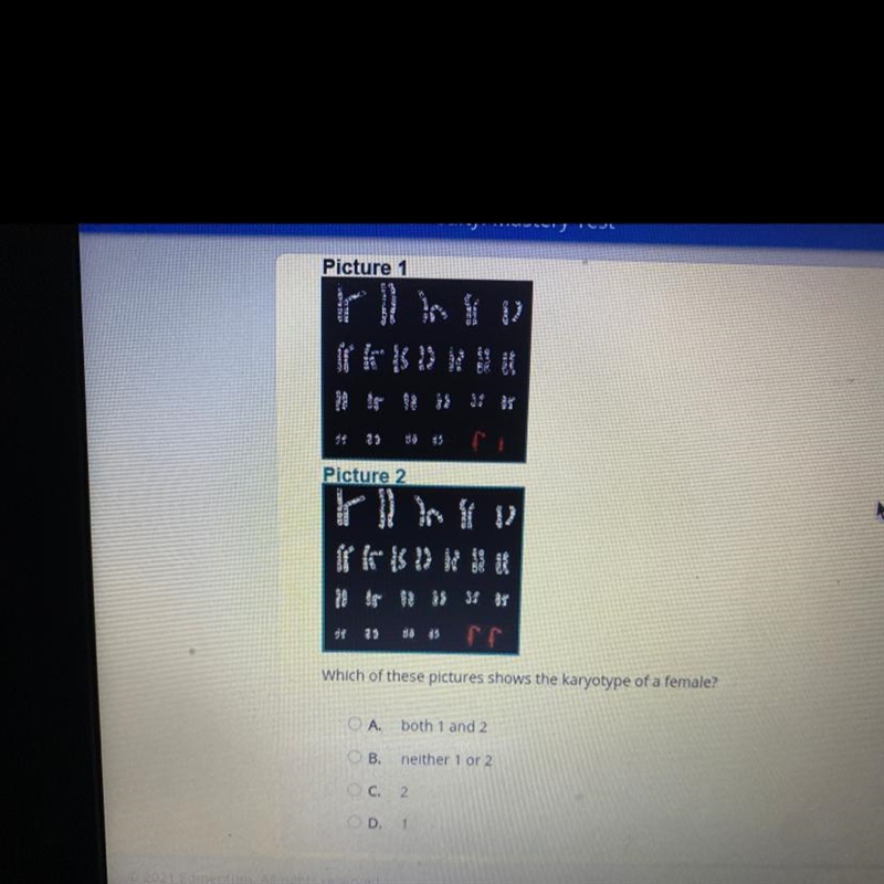 Which of these pictures shows the karyotype of a female? OA both 1 and 2 B. neither-example-1