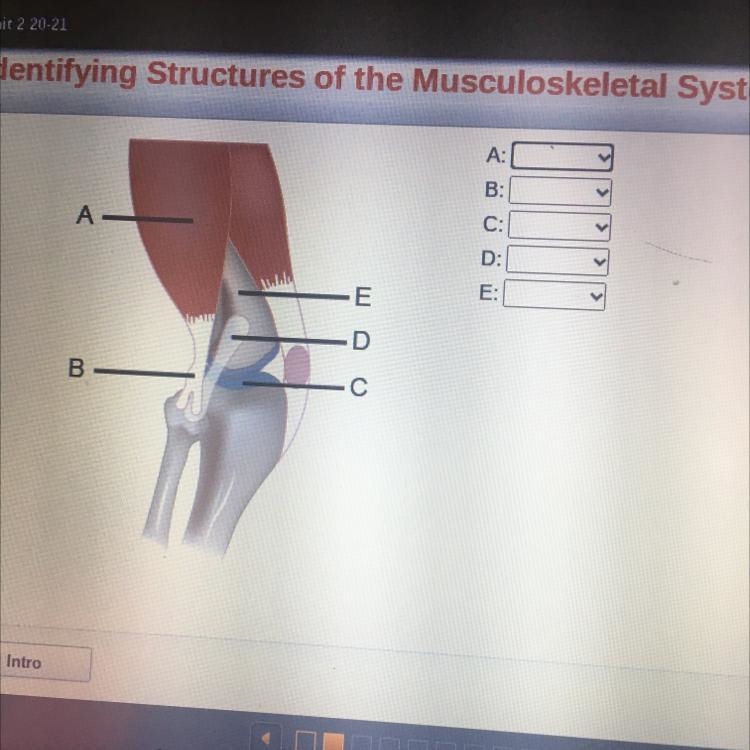 I need help with this (last question I had had the picture all black)-example-1