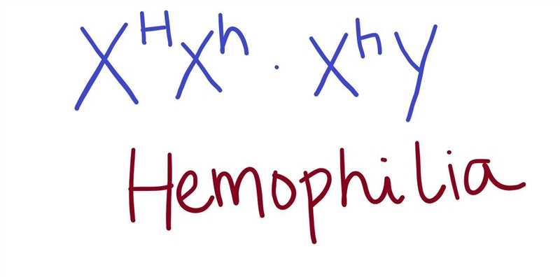 Hemophilia is a sex-linked RECESSIVE disease. If you made a Punnett square from the-example-1