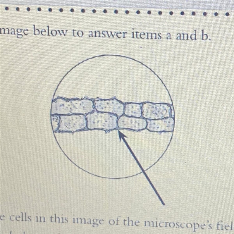 Use the image below to answer items a and b. The cells in this image of the microscope-example-1