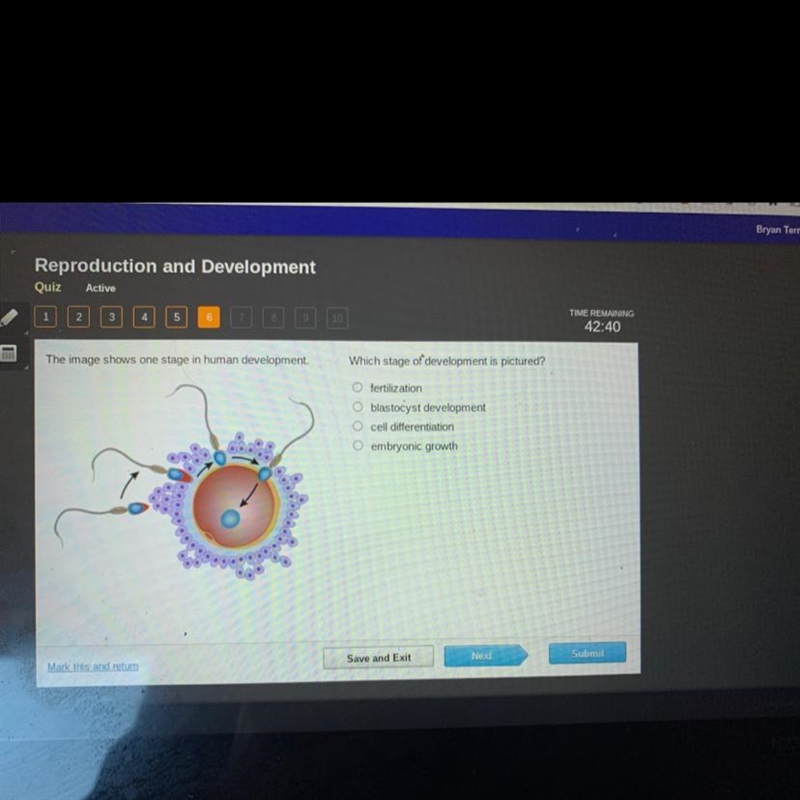 The image shows one stage in human development Which stage of development is pictured-example-1