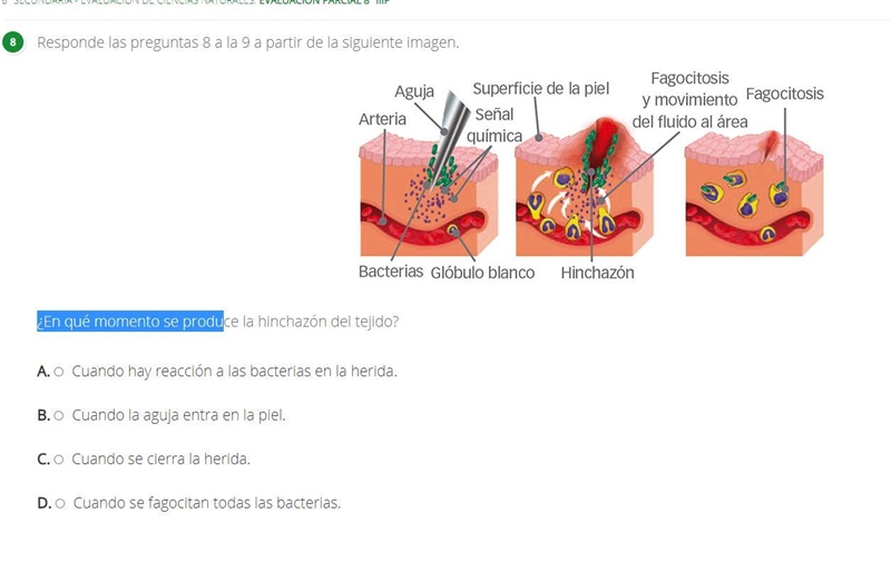 ¿En qué momento se produce la hinchazón del tejido?-example-1