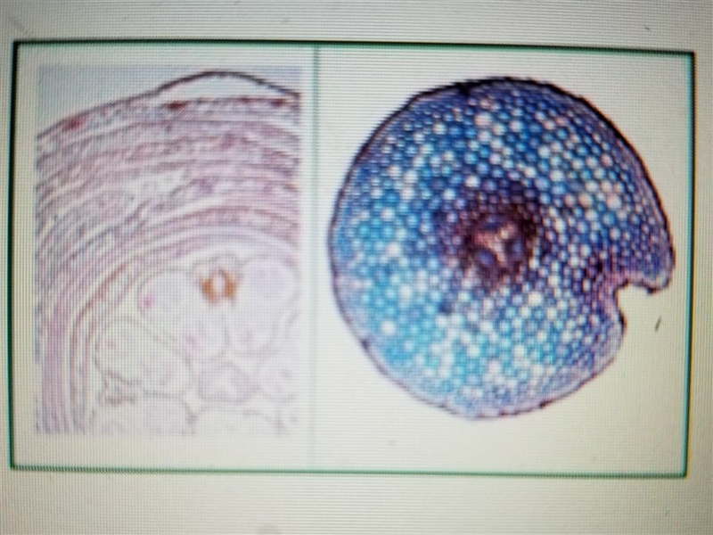 Cross-sections of different areas of the same plant show cells with very different-example-1