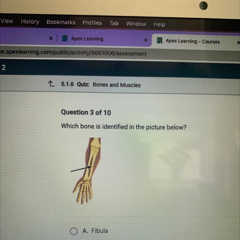 Which bone is identified in the picture below?-example-1