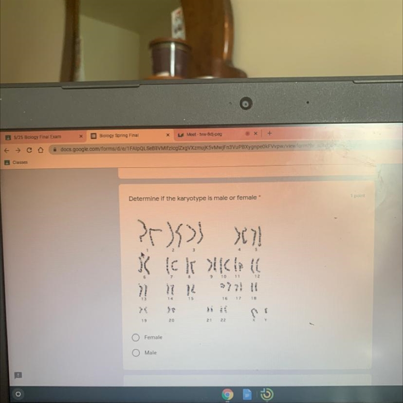 Determine if the karyotype is male or female-example-1