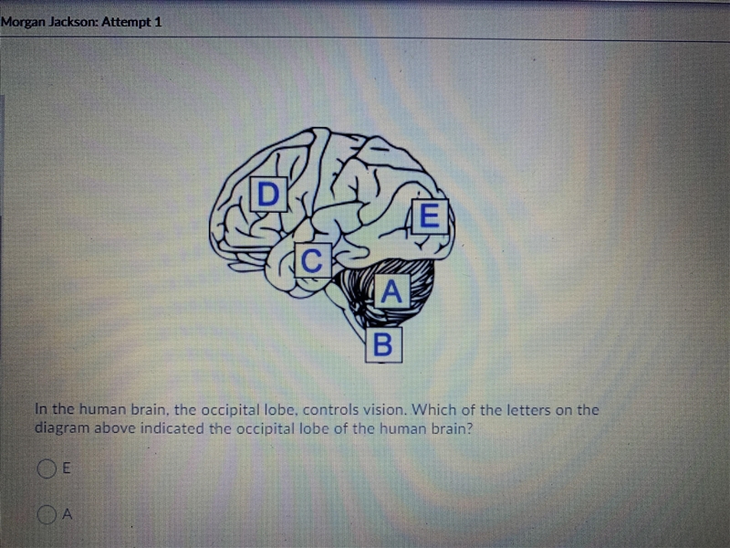 In the human brain, the occipital lobe, controls vision. Which of the letters on the-example-1