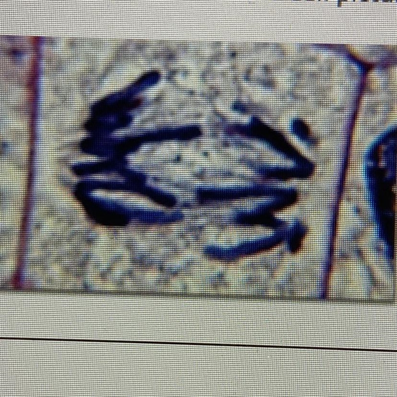 8. What phase of mitosis is the cell pictured below in? Explain how you know that-example-1