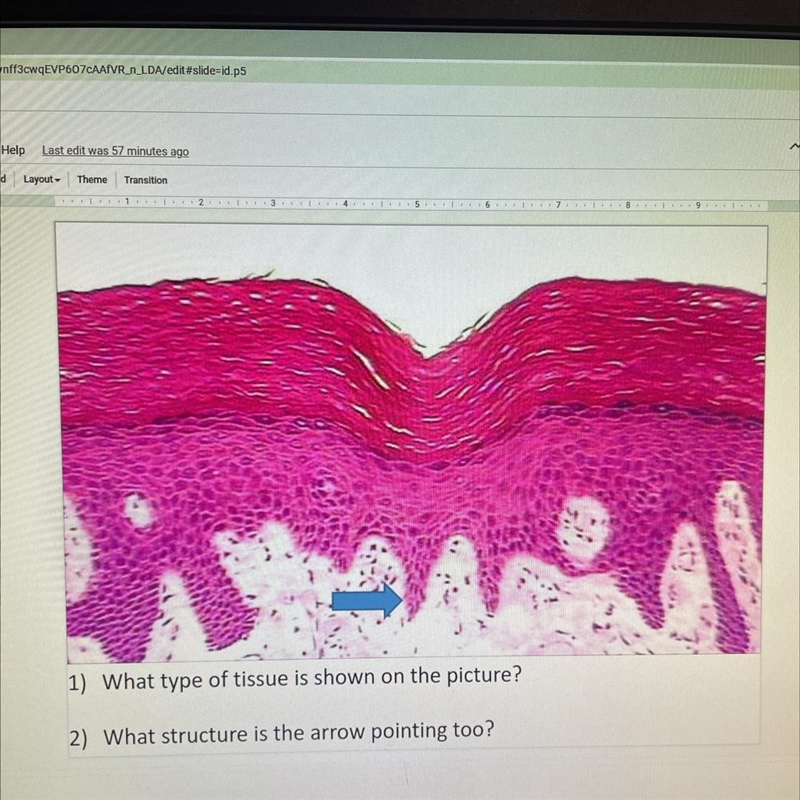 I’d really appreciate the help :)) 1) What type of tissue is shown on the picture-example-1