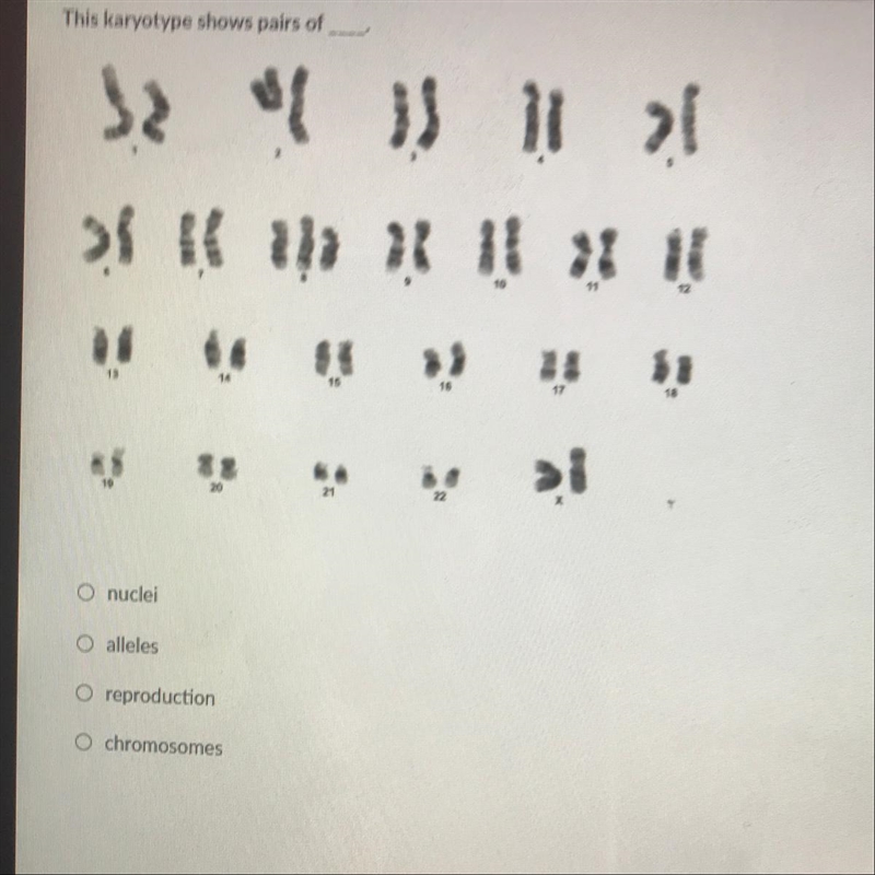 This karyotype shows pairs of a. nuclei b. alleles c. reproduction d. chromosomes-example-1