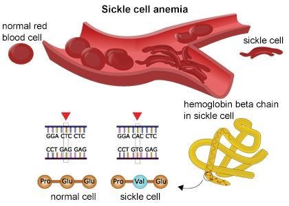 QUESTION: Select the correct answer. Sickle cell disease is a hereditary mutation-example-1