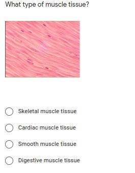 What type of muscle tissue is this-example-1