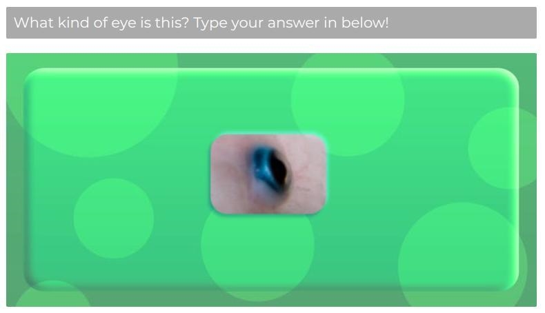 What type of animal eye is this? Who's is it?-example-1