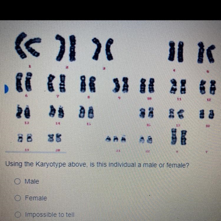 Using the Karyotype above is this individual a male or female? male Female Impossible-example-1