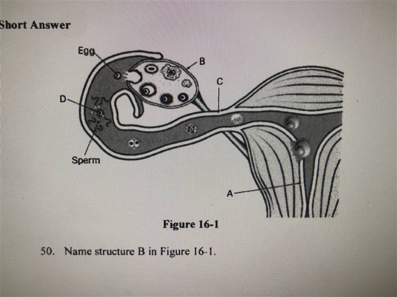 Name structure B in figure 16-1-example-1