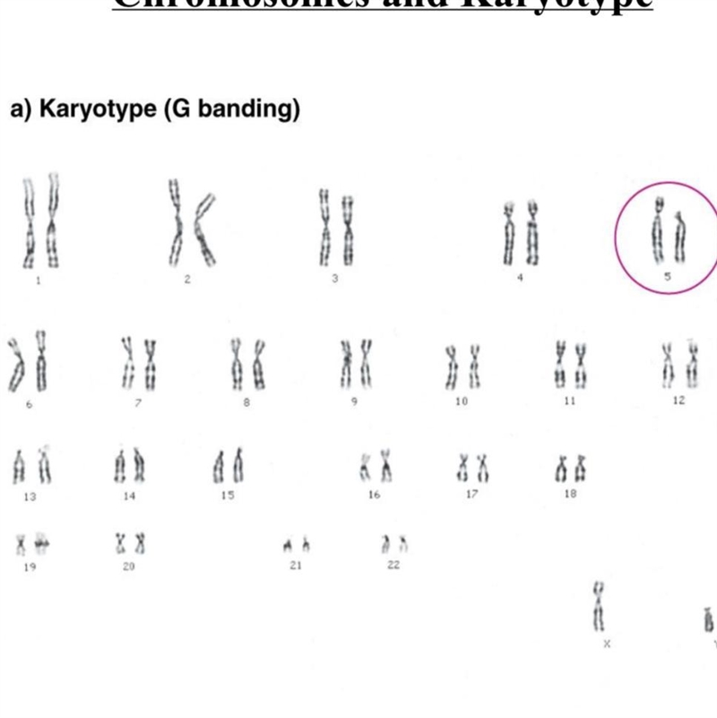 Is this karyotype from a male or female? how do you know ? Also do they have down-example-1