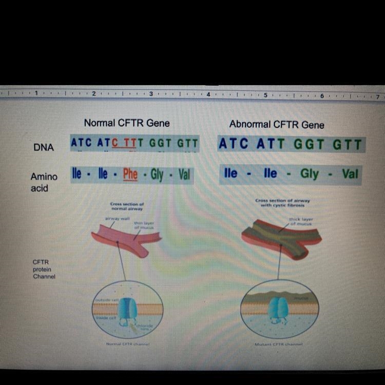 1.Consider the model above compare the DNA sequence of the model and abnormal CFTR-example-1