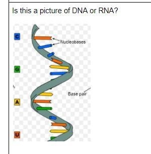 Is this a picture of DNA or RNA?-example-1