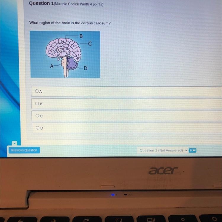 What region of the brain is the corpus callosum? ОА ОВ Ос OD-example-1