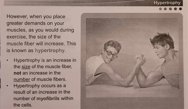 Which of the following correctly describes hypertrophy?-example-2