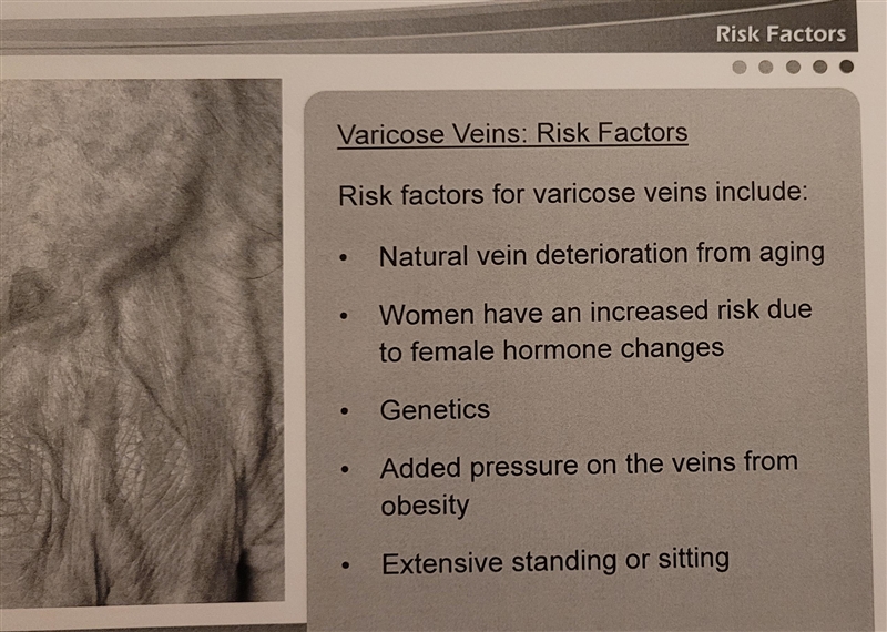 Which of the following people is most likely to develop varicose veins?-example-2