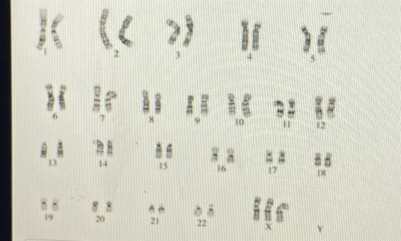 Using the karyotype below and the chart from the last screen: A. Determine the sex-example-1