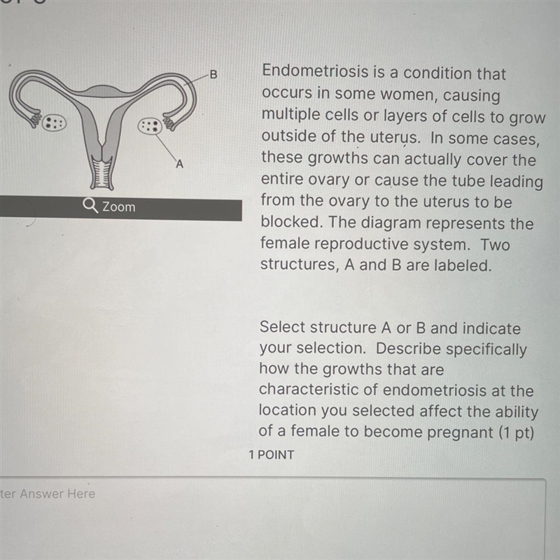 A Endometriosis is a condition that occurs in some women , causing multiple cells-example-1