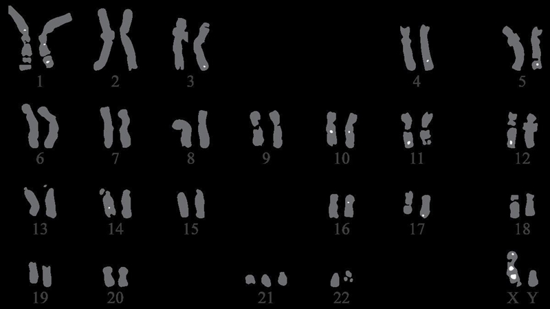 What can be concluded from the following data? #1 DNA profiling of a male with Down-example-1