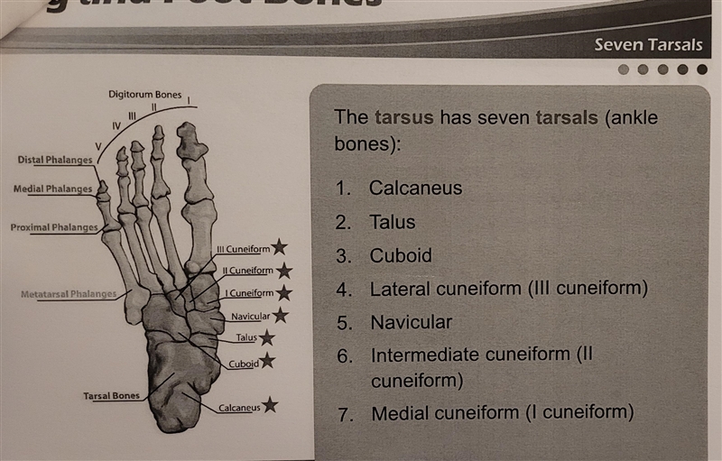 Which of the following is NOT a tarsal bone?-example-2