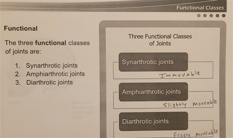 Which type of joint is freely moveable?-example-3