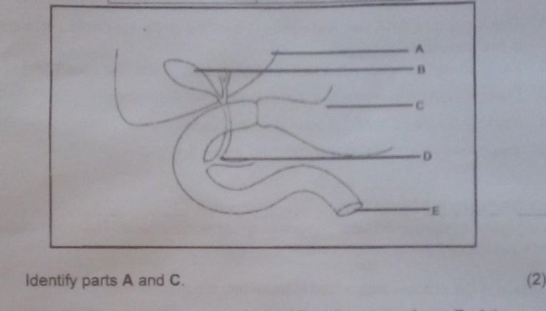 Identify parts A and C.​-example-1