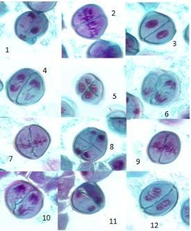 Please please help ASAP Look at the individual cells undergoing Meiosis II and identify-example-1