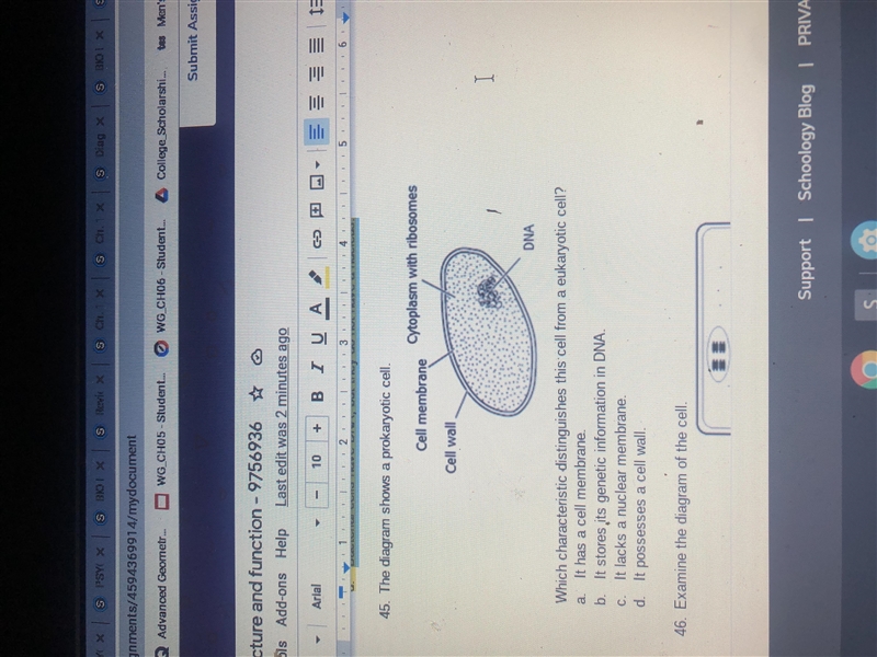 Which characteristic distinguishes this cell from a eukaryotic cell?-example-1