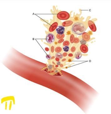 25 POINTS Based on the diagram above, what could be a possible side effect of abnormally-example-1