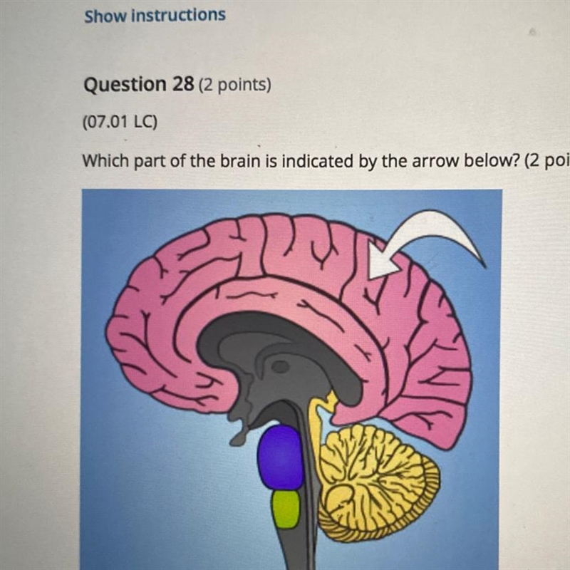 Which part of the brain is indicated by the arrow below? (2 points)-example-1