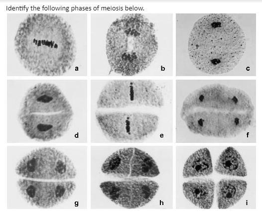 Identify following phases of meiosis (URGENT!)-example-1