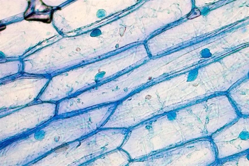 The very structured cells may viewed with a light compound microscope. Are these cells-example-1