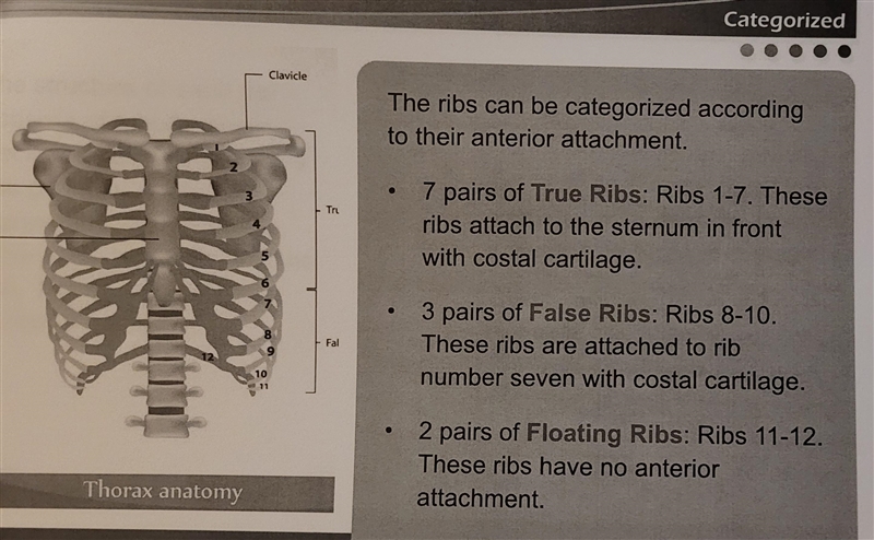 What does costal cartilage connect?-example-3