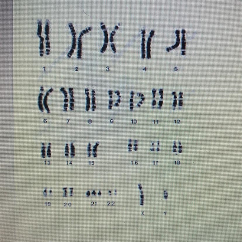 8. What is the sex (gender) of this karyotype?-example-1