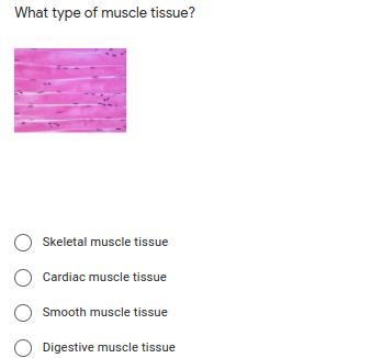 What type of muscle tissue is this-example-1