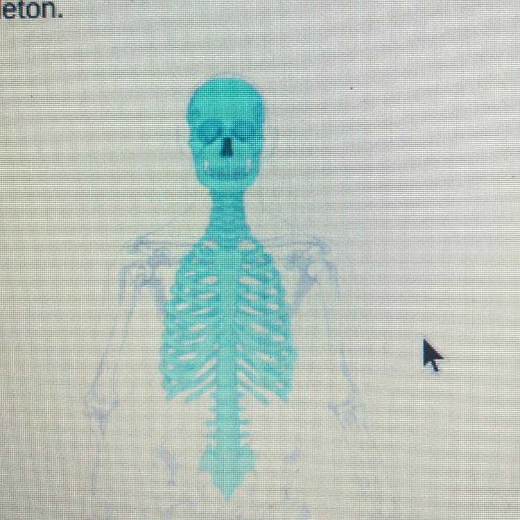 Which skeletal system is represented by the shaded portion of the skeleton? O spongy-example-1