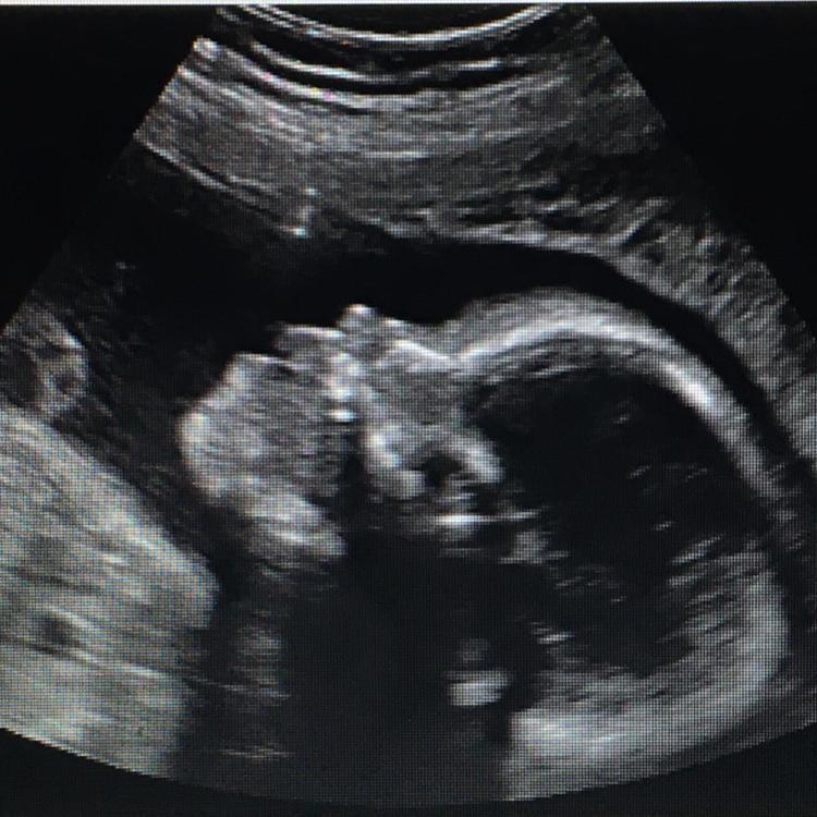 This image of a baby was produced using ultrasound. Which option is the best model-example-1