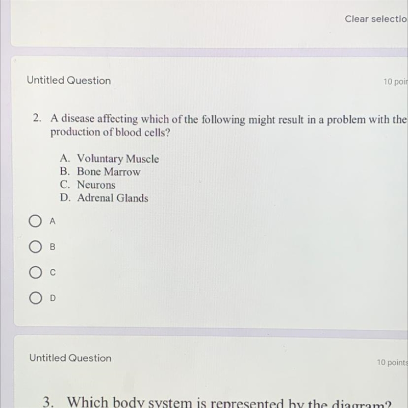 MQ: A disease affecting which of the following might results in a problem with the-example-1