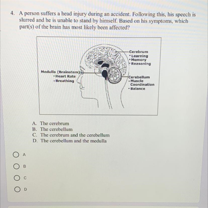 MQ : Which parts of the brain had most likely been affected?-example-1