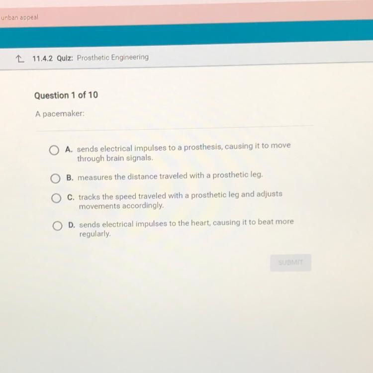 A pacemaker: A. sends electrical impulses to a prosthesis, causing it to move through-example-1
