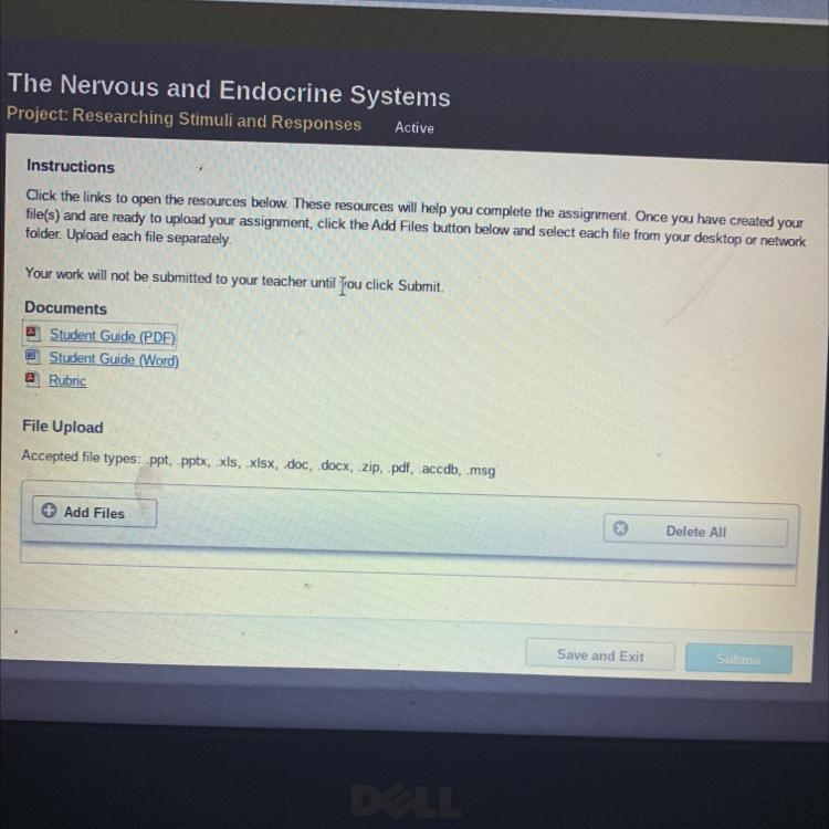 HELP PLEASE!!!! This project is about the nervous and endocrine systems. Click the-example-1