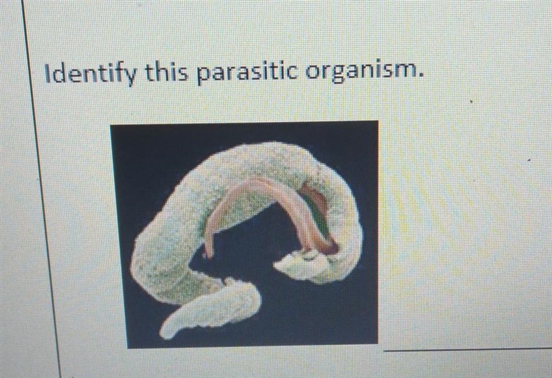 Identify this parasitic organism.​-example-1